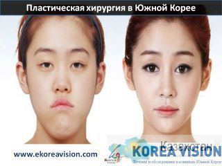 Лечение бесплодия в Южной Корее  без посредников Компания "Korea Vision" Алматы и Алматинская область