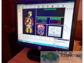 Без анализов и без боли аппарат покажет вам ваши проблемы со здоровьем! Алматы