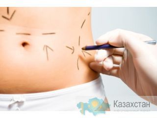 Пластика, подтяжка лица в Германии Алматы и Алматинская область