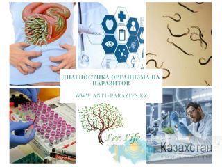 Комплексная диагностика организма на паразитов. г.  Алматы, Таугуль 1-й микрорайон, ул. Навои 50