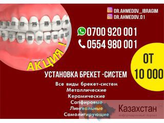 Установка Брекет Систем в Бишкеке по акции Бишкек