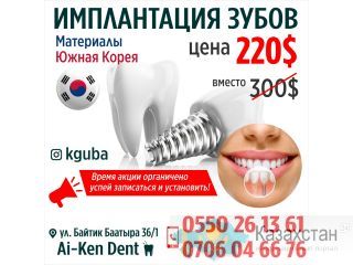 Имплантация зубов Другое месторасположение